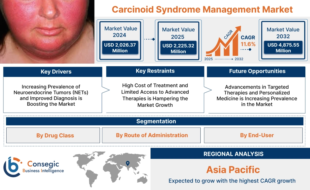 Carcinoid Syndrome Management Market Carcinoid Syndrome Management Market