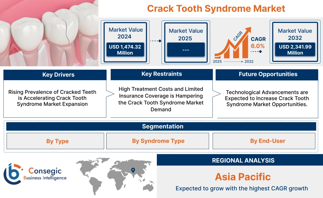 Crack Tooth Syndrome Market Crack Tooth Syndrome Market