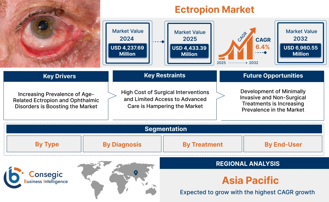 Ectropion Market Ectropion Market
