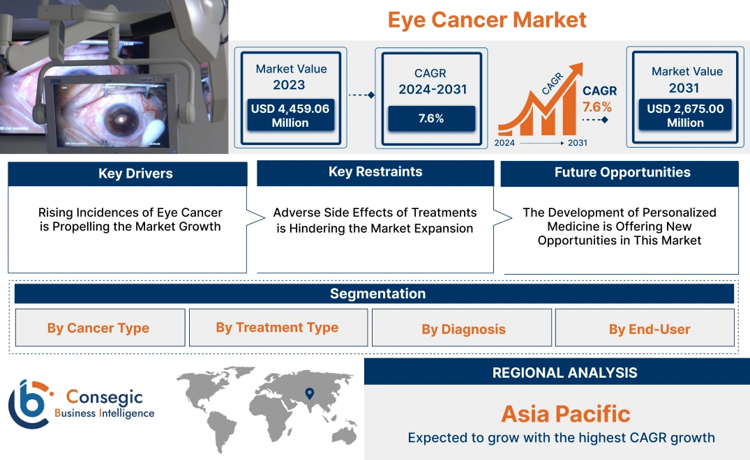 Eye Cancer Market Eye Cancer Market