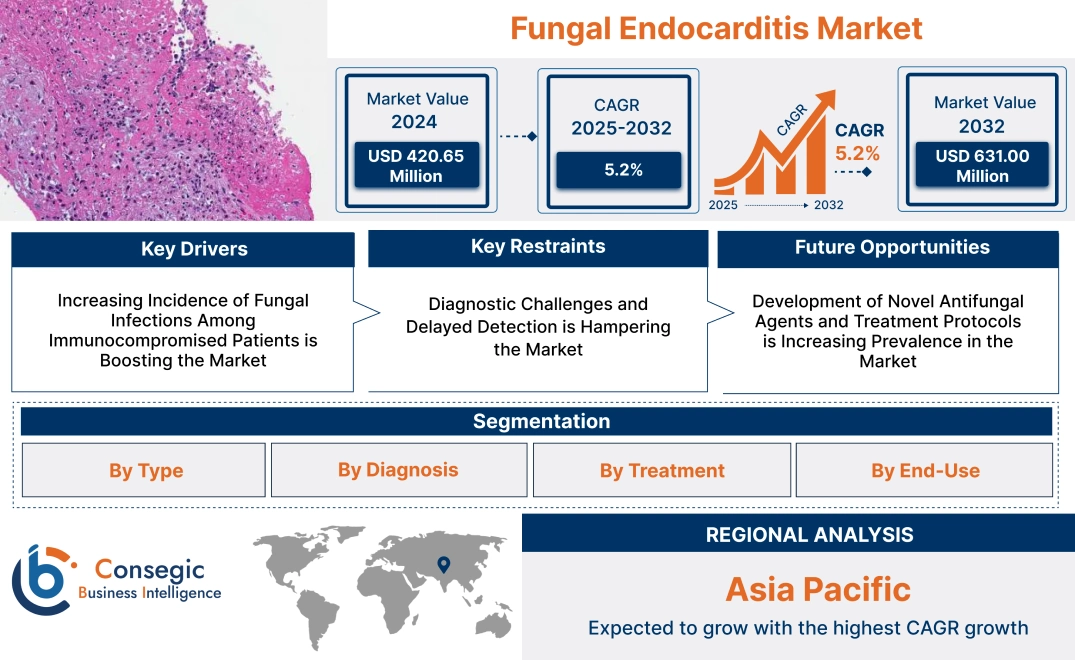 Fungal Endocarditis Market Fungal Endocarditis Market