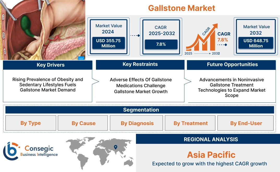 Gallstone Market Gallstone Market