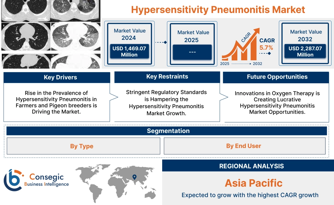 Hypersensitivity Pneumonitis Market Hypersensitivity Pneumonitis Market