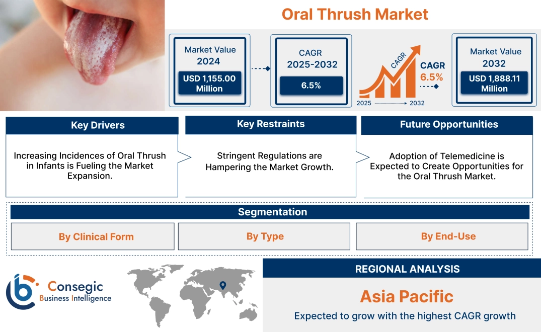 Oral Thrush Market Oral Thrush Market