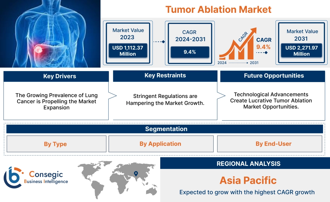 Tumor Ablation Market Tumor Ablation Market