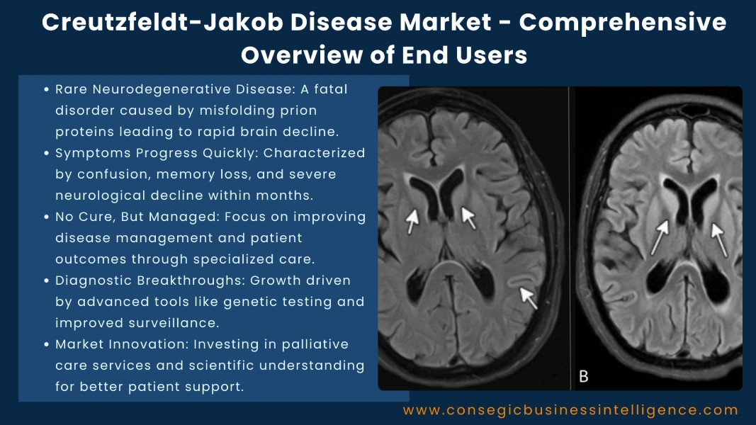 Creutzfeldt-Jakob Disease Market - Comprehensive Overview of End Users Blog